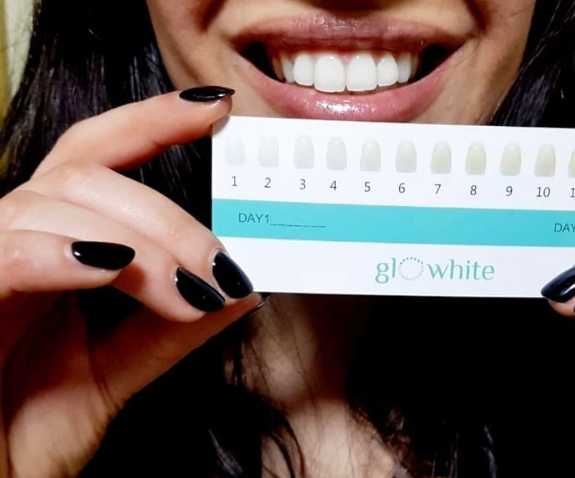 Smart Teeth Whitening Kit